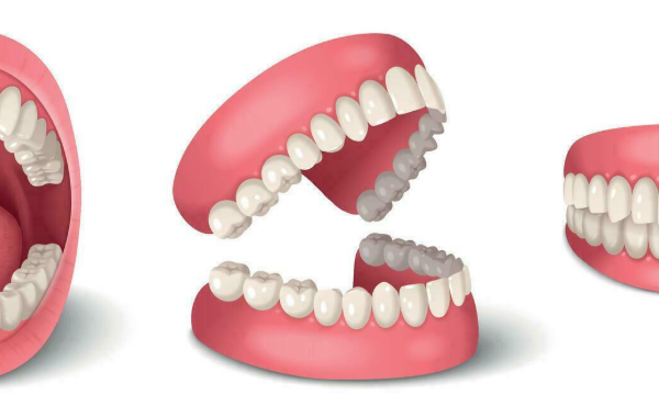 6 Signs You May Need Specialized Jaw Treatment 